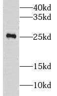 Western Blot: CLRN2 Antibody - BSA Free [NBP3-47580] - Mouse eye tissue were subjected to SDS PAGE followed by western blot with (CLRN2 antibody) at dilution of 1:600