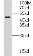 Western Blot CLN3 Antibody - BSA Free