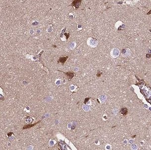 Immunohistochemistry CLN3 Antibody - BSA Free
