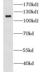 Western Blot: CYLN2 Antibody - BSA Free [NBP3-47585] - Mouse brain tissue were subjected to SDS PAGE followed by western blot with (CYLN2 antibody) at dilution of 1:1000
