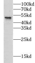 Western Blot: CLEC18A Antibody - BSA Free [NBP3-47588] - HeLa cells were subjected to SDS PAGE followed by western blot with (CLEC18A antibody) at dilution of 1:500