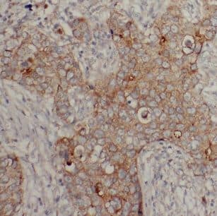 Immunohistochemistry Creatine kinase MT 1A Antibody - BSA Free