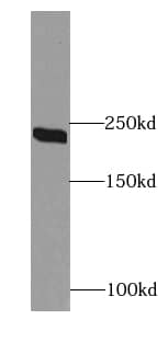 Western Blot: Citron Kinase Antibody - BSA Free [NBP3-47598] - A431 cells were subjected to SDS PAGE followed by western blot with (Citron Kinase antibody) at dilution of 1:600