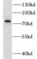 Western Blot: CIRH1A Antibody - BSA Free [NBP3-47600] - SH-SY5Y cells were subjected to SDS PAGE followed by western blot with (CIRH1A antibody) at dilution of 1:500