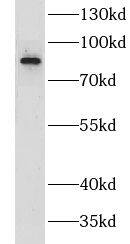 Western Blot CILP2 Antibody - BSA Free