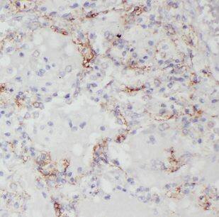 Immunohistochemistry CHSY1 Antibody - BSA Free