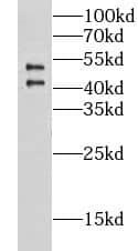 Western Blot: CHST9 Antibody - BSA Free [NBP3-47605] - HepG2 cells were subjected to SDS PAGE followed by western blot with (CHST9 antibody) at dilution of 1:500