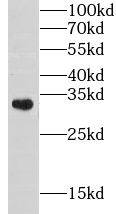 Western Blot: CHST8 Antibody - BSA Free [NBP3-47606] - Mouse heart tissue were subjected to SDS PAGE followed by western blot with (CHST8 antibody) at dilution of 1:1000