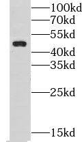 Western Blot CHST14 Antibody - BSA Free
