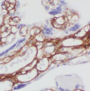 Immunohistochemistry CHST14 Antibody - BSA Free