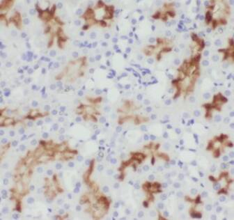Immunohistochemistry CHST13 Antibody - BSA Free
