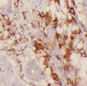 Immunohistochemistry CHST12 Antibody - BSA Free