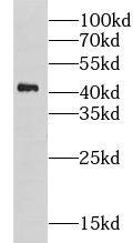 Western Blot: CHST11 Antibody - BSA Free [NBP3-47610] - K-562 cells were subjected to SDS PAGE followed by western blot with (CHST11 antibody) at dilution of 1:500