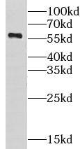 Western Blot: Carbohydrate Sulfotransferase 10/CHST10 Antibody - BSA Free [NBP3-47611] - BxPC-3 cells were subjected to SDS PAGE followed by western blot with (Carbohydrate Sulfotransferase 10/CHST10 antibody) at dilution of 1:400