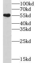 Western Blot: Nicotinic Acetylcholine Receptor beta 4 Antibody - BSA Free [NBP3-47612] - SH-SY5Y cells were subjected to SDS PAGE followed by western blot with (Nicotinic Acetylcholine Receptor beta 4 antibody) at dilution of 1:500