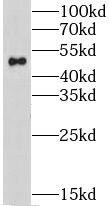 Western Blot: Nicotinic Acetylcholine R alpha 3/CHRNA3 Antibody - BSA Free [NBP3-47616] - Mouse thymus tissue were subjected to SDS PAGE followed by western blot with (Nicotinic Acetylcholine R alpha 3/CHRNA3 antibody) at dilution of 1:1000