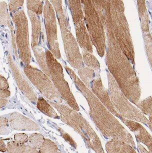Immunohistochemistry Nicotinic Acetylcholine R alpha 1/CHRNA1 Antibody - BSA Free