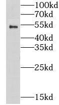 Western Blot: Nicotinic Acetylcholine R alpha 1/CHRNA1 Antibody - BSA Free [NBP3-47618] - Mouse heart tissue were subjected to SDS PAGE followed by western blot with (Nicotinic Acetylcholine R alpha 1/CHRNA1 Antibody) at dilution of 1:300