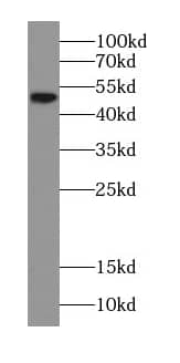 Western Blot: Choline kinase alpha Antibody - BSA Free [NBP3-47620] - COLO 320 cells were subjected to SDS PAGE followed by western blot with (Choline kinase alpha-Specific antibody) at dilution of 1:300