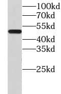 Western Blot: CHMP7 Antibody - BSA Free [NBP3-47621] - HEK-293 cells were subjected to SDS PAGE followed by western blot with (CHMP7 Antibody) at dilution of 1:1000