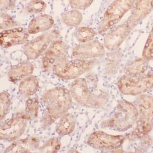 Immunohistochemistry CHMP7 Antibody - BSA Free