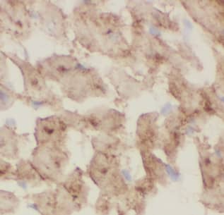 Immunohistochemistry: CHCHD10 Antibody - BSA Free [NBP3-47630] - Immunohistochemistry of paraffin-embedded human heart tissue slide using (CHCHD10 Antibody) at dilution of 1:50