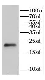 Western Blot: CHAC2 Antibody - BSA Free [NBP3-47632] - Jurkat cells were subjected to SDS PAGE followed by western blot with (CHAC2 antibody) at dilution of 1:1500