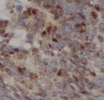 Immunohistochemistry CGNL1 Antibody - BSA Free