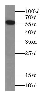 Western Blot CES7 Antibody - BSA Free