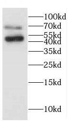 Western Blot: CEECAM1 Antibody - BSA Free [NBP3-47636] - HEK-293 cells were subjected to SDS PAGE followed by western blot with (CEECAM1 antibody) at dilution of 1:1500