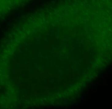 Immunocytochemistry/ Immunofluorescence: CEPT1 Antibody - BSA Free [NBP3-47637] - Immunofluorescent analysis of HepG2 cells, using CEPT1 antibody  at 1:25 dilution and FITC-goat anti-Rabbit IgG (green).