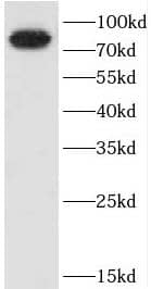 Western Blot: CEP72 Antibody - BSA Free [NBP3-47639] - HeLa cells were subjected to SDS PAGE followed by western blot with (CEP72 antibody) at dilution of 1:1000