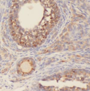 Immunohistochemistry CEP70 Antibody - BSA Free