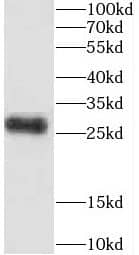 Western Blot CEP70 Antibody - BSA Free