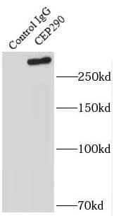 Immunoprecipitation: CEP290 Antibody - BSA Free [NBP3-47642] - IP result of anti-CEP290( for IP and Detection)with HeLa cells.