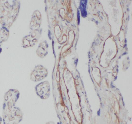 Immunohistochemistry: CEP290 Antibody - BSA Free [NBP3-47642] - Immunohistochemistry of paraffin-embedded human placenta using (CEP290 antibody) at dilution of 1:50