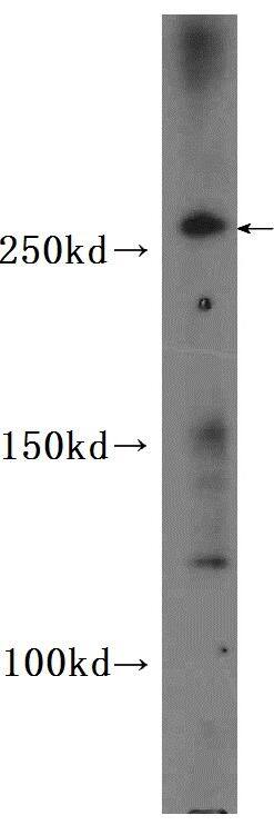 Western Blot: CEP290 Antibody - BSA Free [NBP3-47642] - HeLa cells were subjected to SDS PAGE followed by western blot with (CEP290 Antibody) at dilution of 1:600
