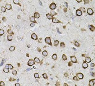 Immunohistochemistry: CEP164 Antibody - BSA Free [NBP3-47644] - Immunohistochemistry of paraffin-embedded mouse brain using ( CEP164 Antibody) at dilution of 1:50