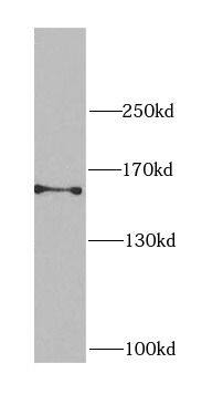 Western Blot: CEP164 Antibody - BSA Free [NBP3-47644] - HEK-293 cells were subjected to SDS PAGE followed by western blot with ( CEP164 Antibody) at dilution of 1:1000