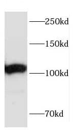 Western Blot: CEP152 Antibody - BSA Free [NBP3-47645] - Mouse brain tissue were subjected to SDS PAGE followed by western blot with ( CEP152 Antibody) at dilution of 1:300