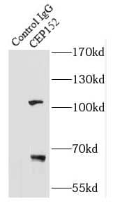 Immunoprecipitation: CEP152 Antibody - BSA Free [NBP3-47645] - IP Result of anti-CEP152 (IP:, 3ug; Detection: 1:500) with mouse brain tissue lysate 9500ug.