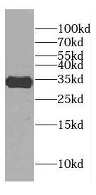 Western Blot: CENPP Antibody - BSA Free [NBP3-47647] - HEK-293T cells were subjected to SDS PAGE followed by western blot with ( CENPP Antibody) at dilution of 1:600