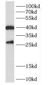Western Blot: CENPN Antibody - BSA Free [NBP3-47649] - MCF-7 cells were subjected to SDS PAGE followed by western blot with (CENPN Antibody) at dilution of 1:1000