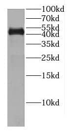 Western Blot: CENPL Antibody - BSA Free [NBP3-47650] - PC-3 cells were subjected to SDS PAGE followed by western blot with (CENPL antibody) at dilution of 1:300