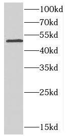 Western Blot: CDS2 Antibody - BSA Free [NBP3-47652] - Y79 cells were subjected to SDS PAGE followed by western blot with (CDS2 antibody) at dilution of 1:500