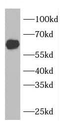Western Blot: CDKAL1 Antibody - BSA Free [NBP3-47654] - Mouse lung tissue were subjected to SDS PAGE followed by western blot with (CDKAL1 antibody) at dilution of 1:2000