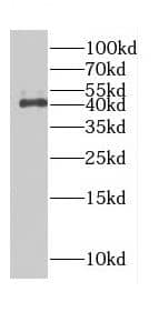 Western Blot: Cdk3 Antibody - BSA Free [NBP3-47655] - Mouse brain were subjected to SDS PAGE followed by western blot with (Cdk3 antibody) at dilution of 1:2000