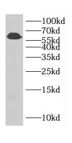 Western Blot: Cadherin-23 Antibody - BSA Free [NBP3-47658] - A172 cells were subjected to SDS PAGE followed by western blot with (Cadherin-23 antibody) at dilution of 1:1000