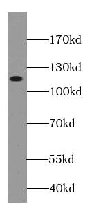 Western Blot: Cadherin-10 Antibody - BSA Free [NBP3-47659] - Rat brain tissue were subjected to SDS PAGE followed by western blot with (Cadherin-10 antibody) at dilution of 1:500