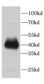 Western Blot CDCA7 Antibody - BSA Free